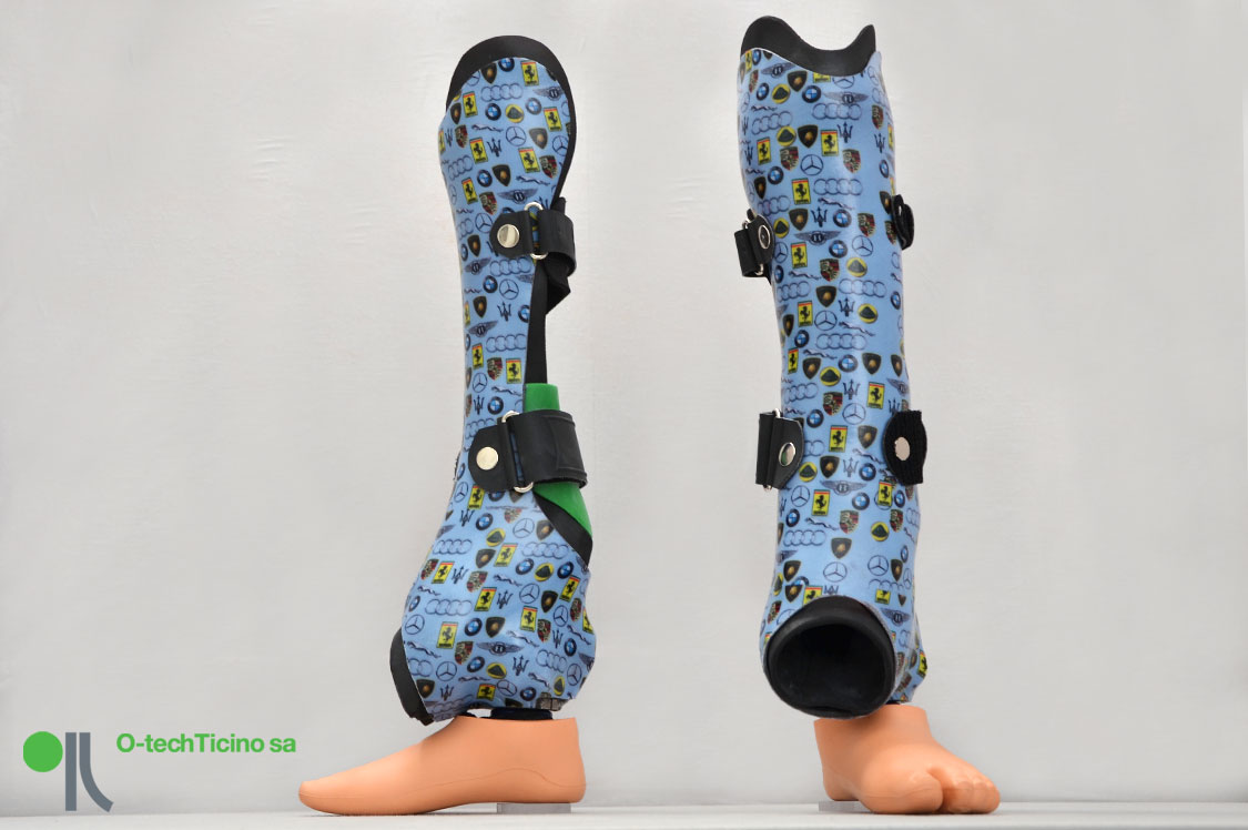 Orto-protesi
